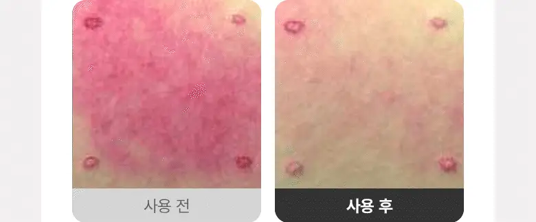 [장벽크림] 바이오힐 보 판테셀 리페어 시카좀 크림 80mL [단품/증정기획] 상세페이지 19